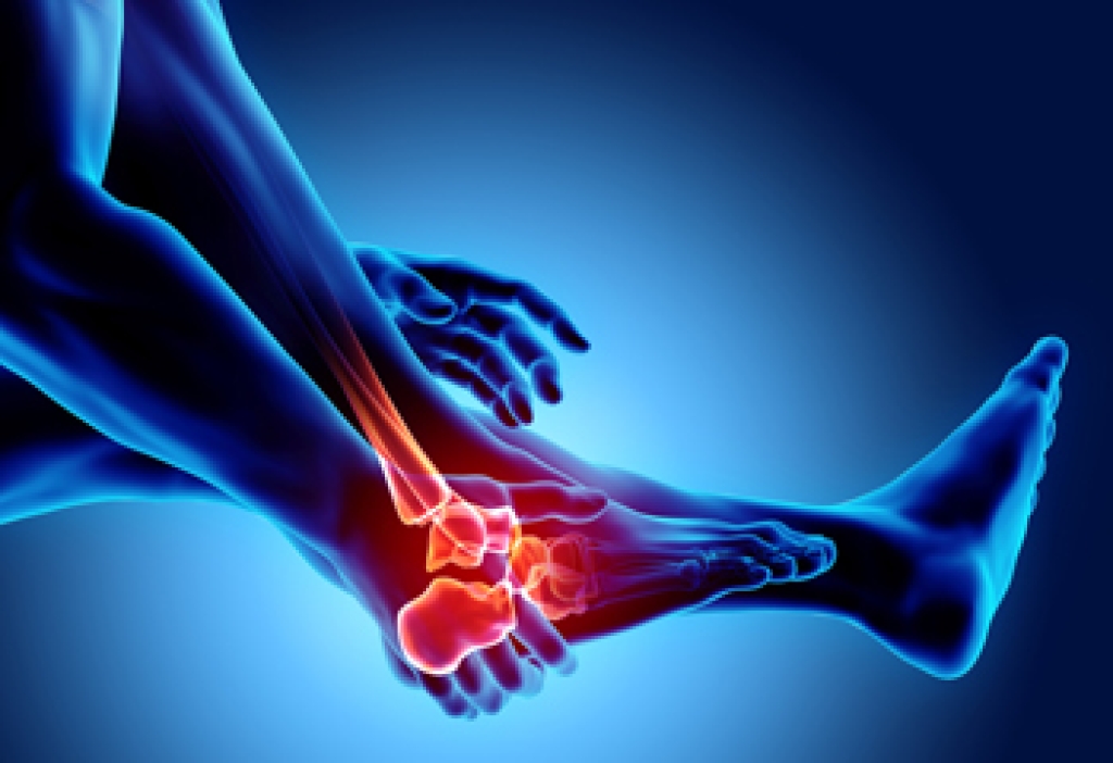 Various Types of Arthritis