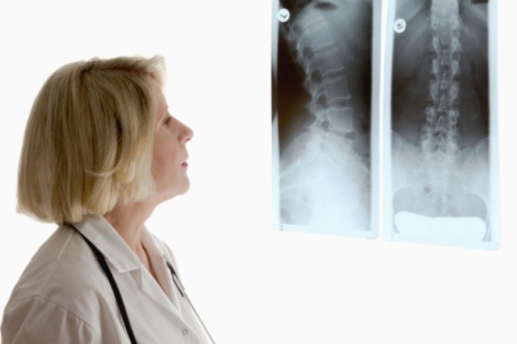 Understanding Bulging and Herniated Discs in the Spine