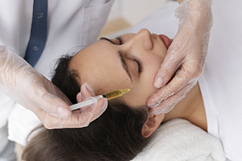 PRP facial treatment