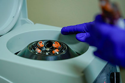 prp injections